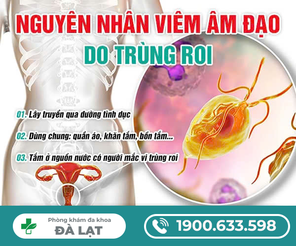 Hình ảnh minh họa